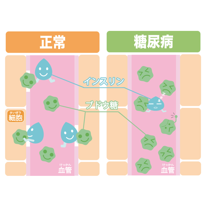 糖尿病とはどんな病気？