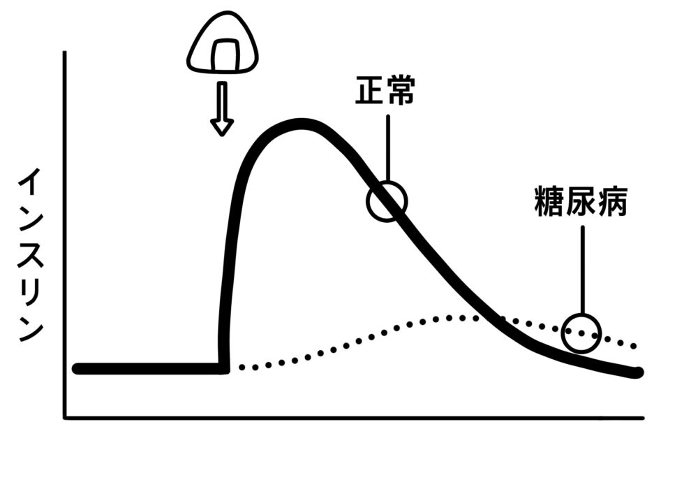 糖尿病とは